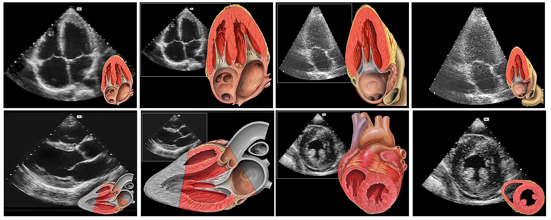 Standard transthoracic echocardiography views