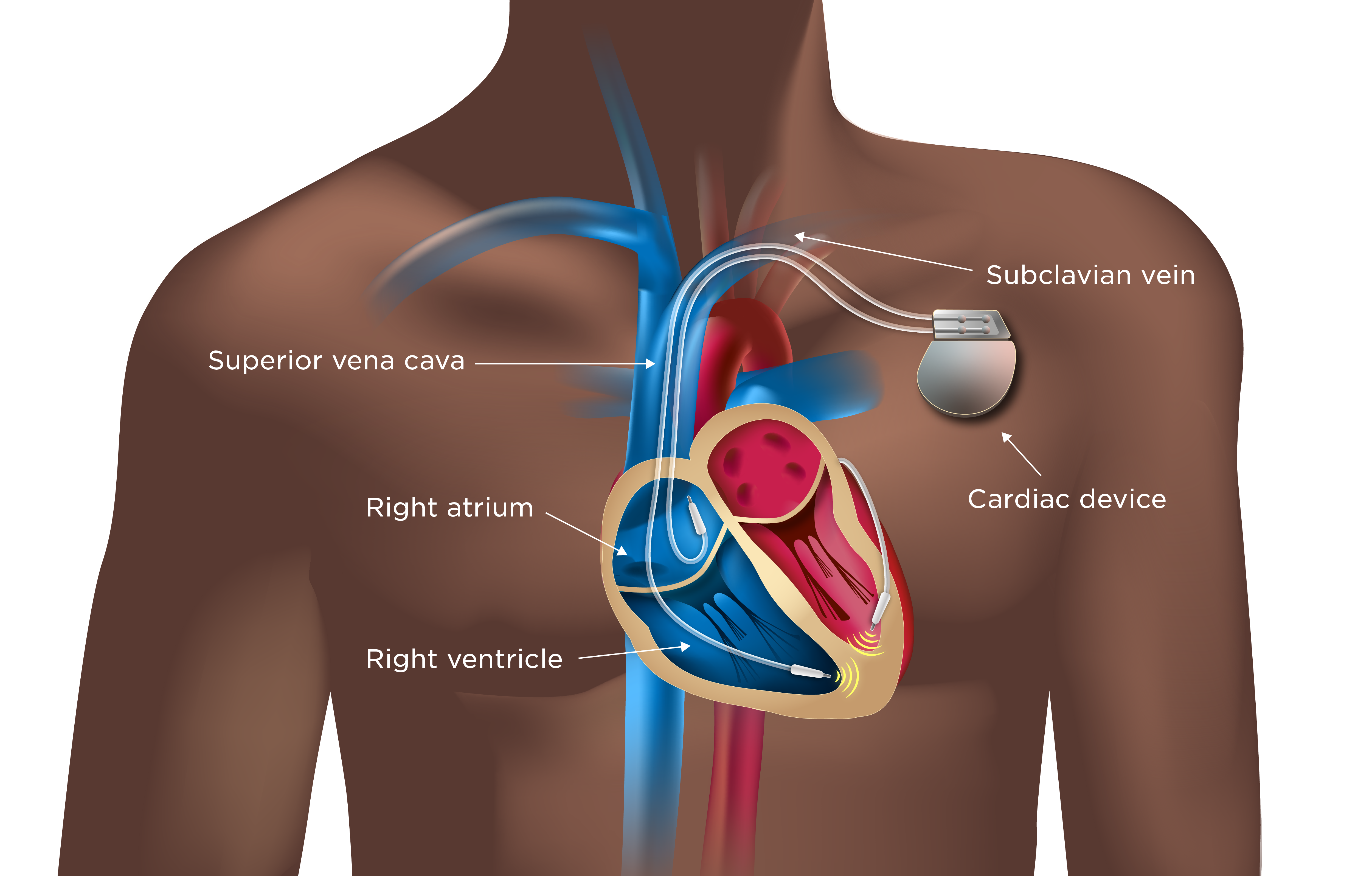 First Impressions: Life as a Cardiology Registrar
